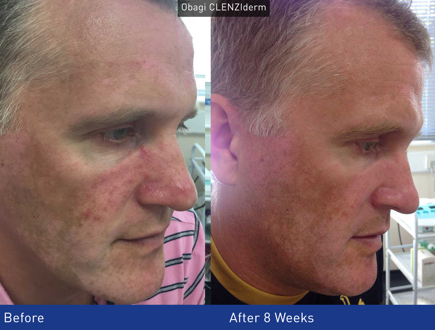 Obagi Medical Medical Grade Skincare Face Perfect Clinic Leeds